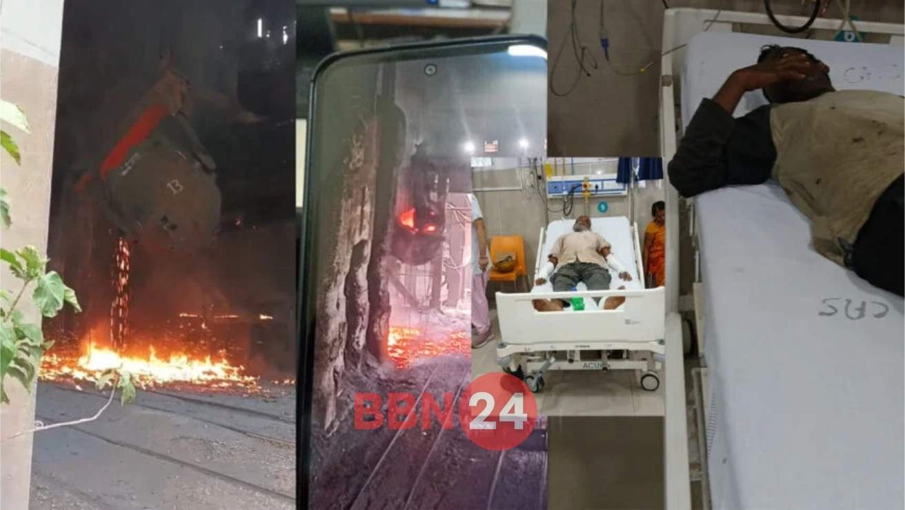 Bokaro Steel Plant Hot Metal Accident 5 Workers Burned