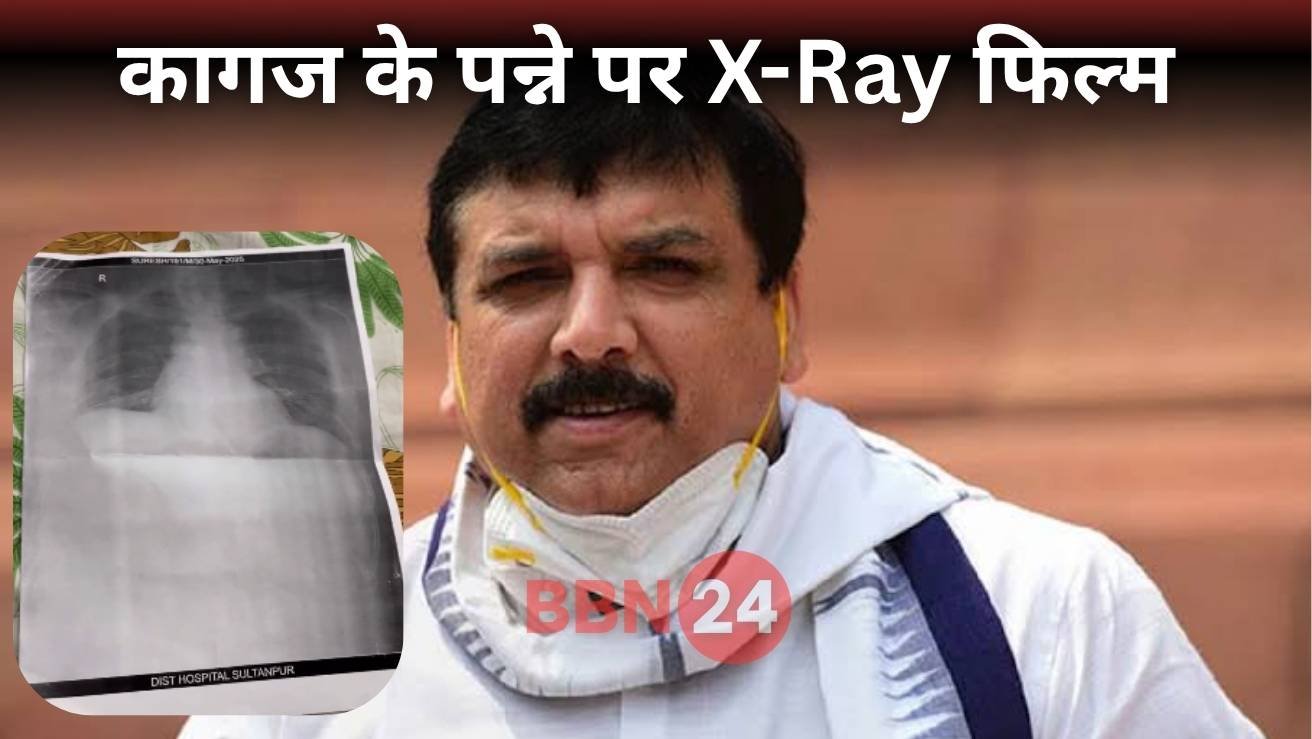 Sultanpur Hospital Paper Xray Crisis